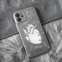 Load image into Gallery viewer, Metal plating
